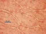 7 - Dettaglio di un filamento midollare con cellula secretrice
